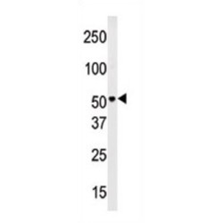 PMAT Antibody