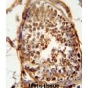 DnaJ (Hsp40) Homolog, Subfamily B, Member 13 (DNAJB13) Antibody