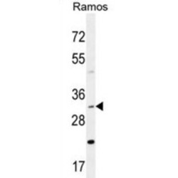 DnaJ (Hsp40) Homolog, Subfamily B, Member 13 (DNAJB13) Antibody