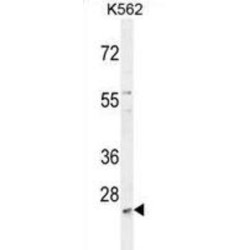 MCART2 Antibody