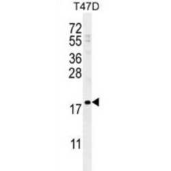 Late Cornified Envelope Protein 1A (LCE1A) Antibody