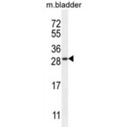 TRAF-Interacting Protein With FHA Domain-Containing Protein B (TIFAB) Antibody