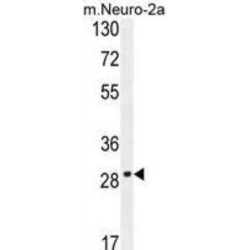 Olfactory Receptor Family 9 Subfamily Q Member 1 (OR9Q1) Antibody