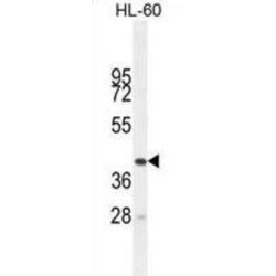 Butyrophilin-Like Protein 3 (BTNL3) Antibody