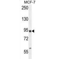 EF-Hand Domain-Containing Family Member B (EFHB) Antibody