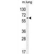 Nuclear Factor Erythroid 2-Related Factor 1 (NFE2L1) Antibody