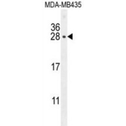 Placental Lactogen (CSH1) Antibody