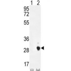 Placental Lactogen (CSH1) Antibody