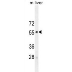 Mitogen-Activated Protein Kinase 8 / JNK1 (MAPK8) Antibody