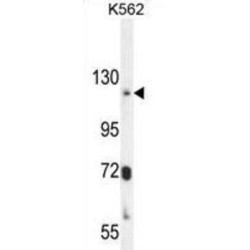 Phospholipid-Transporting ATPase IB (ATP8A2) Antibody