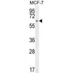 CTD Small Phosphatase-Like Protein 2 (CTDSPL2) Antibody