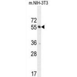 CTD Small Phosphatase-Like Protein 2 (CTDSPL2) Antibody