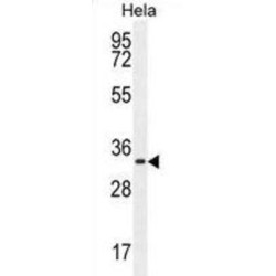 Cyclin-H (CCNH) Antibody