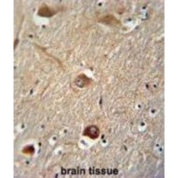 Clusterin (CLU) Antibody