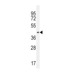 Immunoglobulin Heavy Constant Gamma 1 (G1m Marker) (IGHG1) Antibody