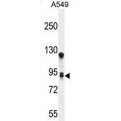 Transmembrane Protein 168 (TM168) Antibody