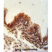 Thioredoxin Domain-Containing Protein 6 (TXNDC6) Antibody