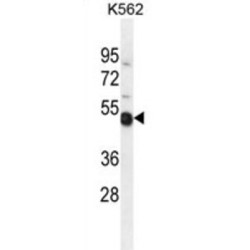 Thioredoxin Domain-Containing Protein 6 (TXNDC6) Antibody