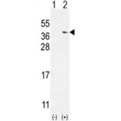 Thioredoxin Domain-Containing Protein 6 (TXNDC6) Antibody