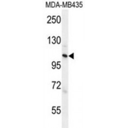 Zinc Finger CCCH Domain-Containing Protein 3 (ZC3H3) Antibody