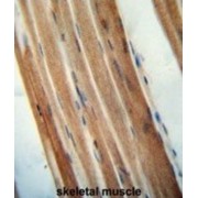 Transmembrane And Coiled-Coil Domain-Containing Protein 7 (TMCO7) Antibody