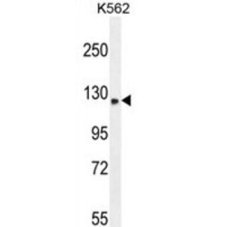 Transmembrane And Coiled-Coil Domain-Containing Protein 7 (TMCO7) Antibody