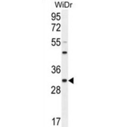 RILP-Like Protein 2 (RILPL2) Antibody