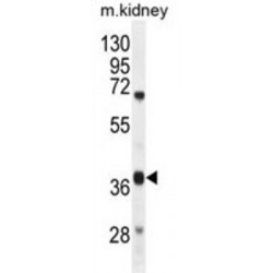 Dihydrouridine Synthase 4 Like (DUS4L) Antibody