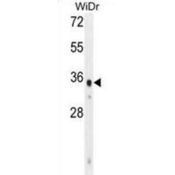 WD Repeat-Containing Protein 5B (WDR5B) Antibody