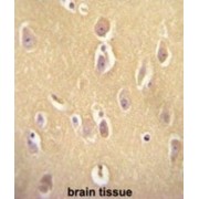 Olfactory Receptor 13J1 (OR13J1) Antibody