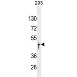 Olfactory Receptor 13J1 (OR13J1) Antibody