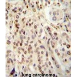 Transglutaminase-6 (TGM6) Antibody