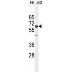 Transglutaminase-6 (TGM6) Antibody