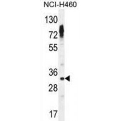 Olfactory Receptor Family 2 Subfamily Z Member 1 (OR2Z1) Antibody