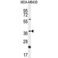 Olfactory Receptor 6V1 (OR6V1) Antibody