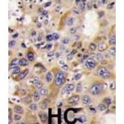 Histone Deacetylase 6 (HDAC6) Antibody