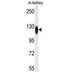 Histone Deacetylase 6 (HDAC6) Antibody