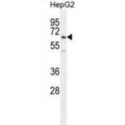 Ubiquitin Family Domain Containing 1 (UBFD1) Antibody