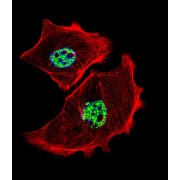 Upstream Stimulatory Factor 1 (USF1) Antibody