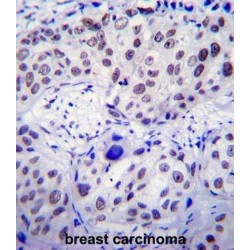 Upstream Stimulatory Factor 1 (USF1) Antibody