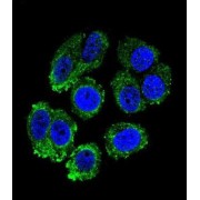 Arginine--tRNA Ligase, Cytoplasmic (RARS1) Antibody