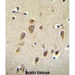 Arginine--tRNA Ligase, Cytoplasmic (RARS1) Antibody