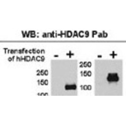 Histone Deacetylase 9 (HDAC9) Antibody