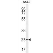 Transcription Factor BTF3 (BTF3) Antibody