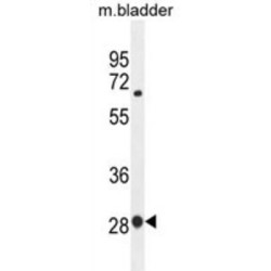 Transcription Factor BTF3 (BTF3) Antibody