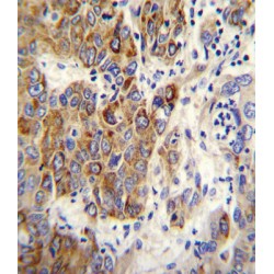 Cytochrome P450 Family 2 Subfamily B Member 6 (CYP2B6) Antibody