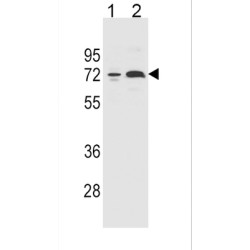 Cytochrome P450 Family 2 Subfamily B Member 6 (CYP2B6) Antibody