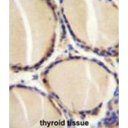 Calcitonin (CALCA) Antibody