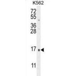 Calcitonin (CALCA) Antibody