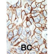 Histone Deacetylase 11 (HDAC11) Antibody